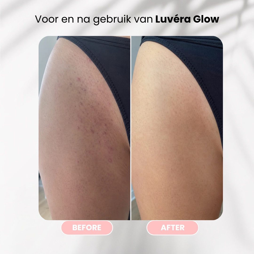 Luvéra 12-Week Glow