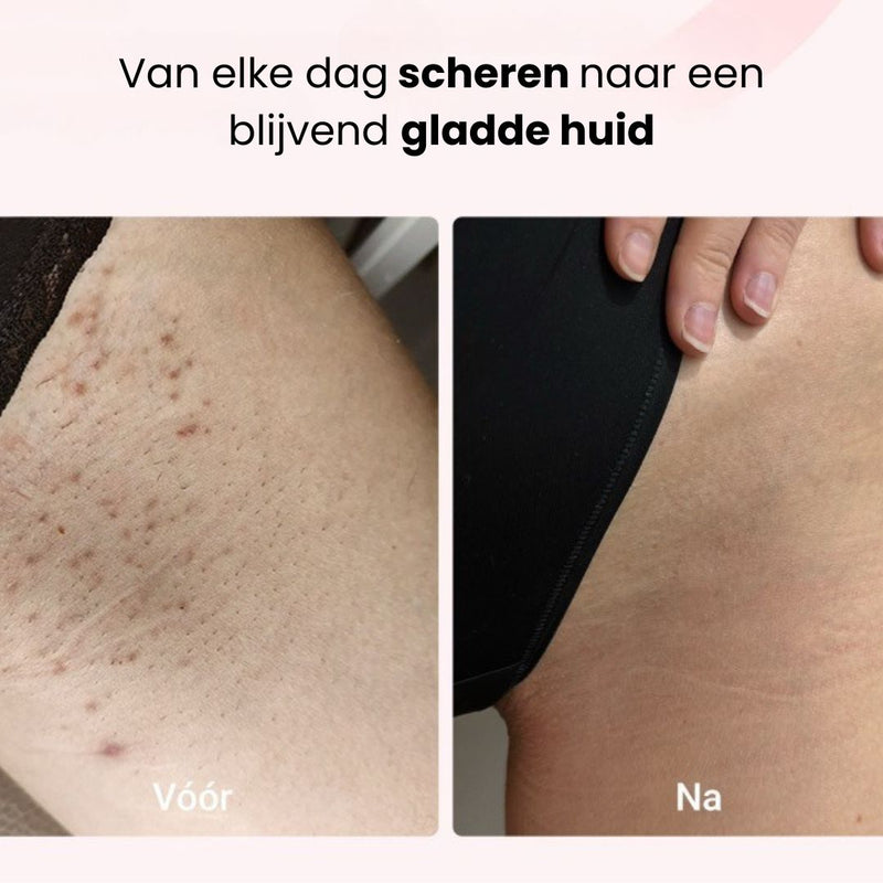 Blijvend resultaat